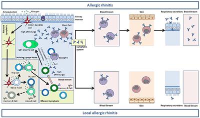 Diagnostic Tools in Allergic Rhinitis